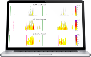 Wavelet Analysis EMG