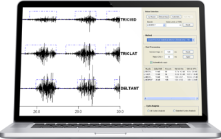 Muscle Activation Analysis