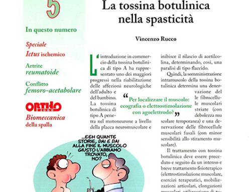 Emiplegia: alterazioni del cammino