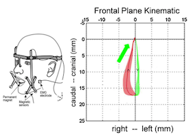 software for the myotronics K7
