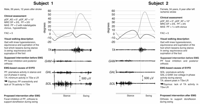 Comparison of patients with same gait patterns