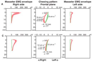 masticatory muscle activity masseter activity