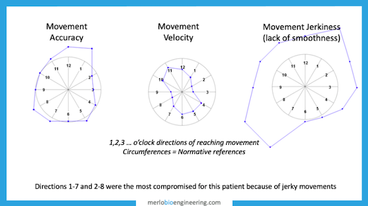 upper limb motion indices new indices