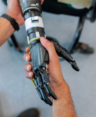 stroke and robotics robotic rehabilitation