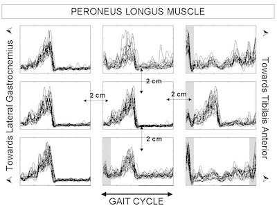 electrode placement on peroneus peroneus longus