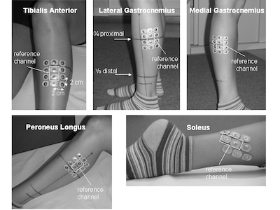 electrode placement on lower limb muscles electrode placement
