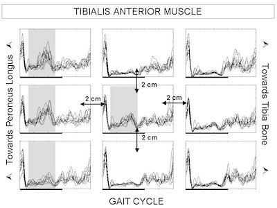 tibialis envelope tibialis anterior