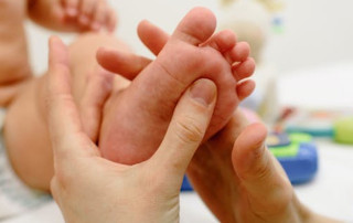 Equinovalgus foot deformity