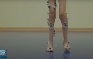 Gait Variable Score and Gait Profile Score