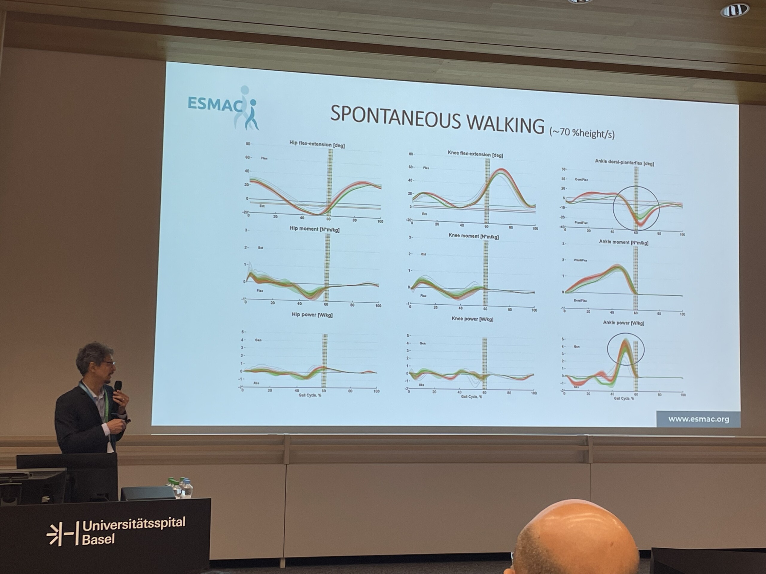 Gait analysis and Parkinson's disease