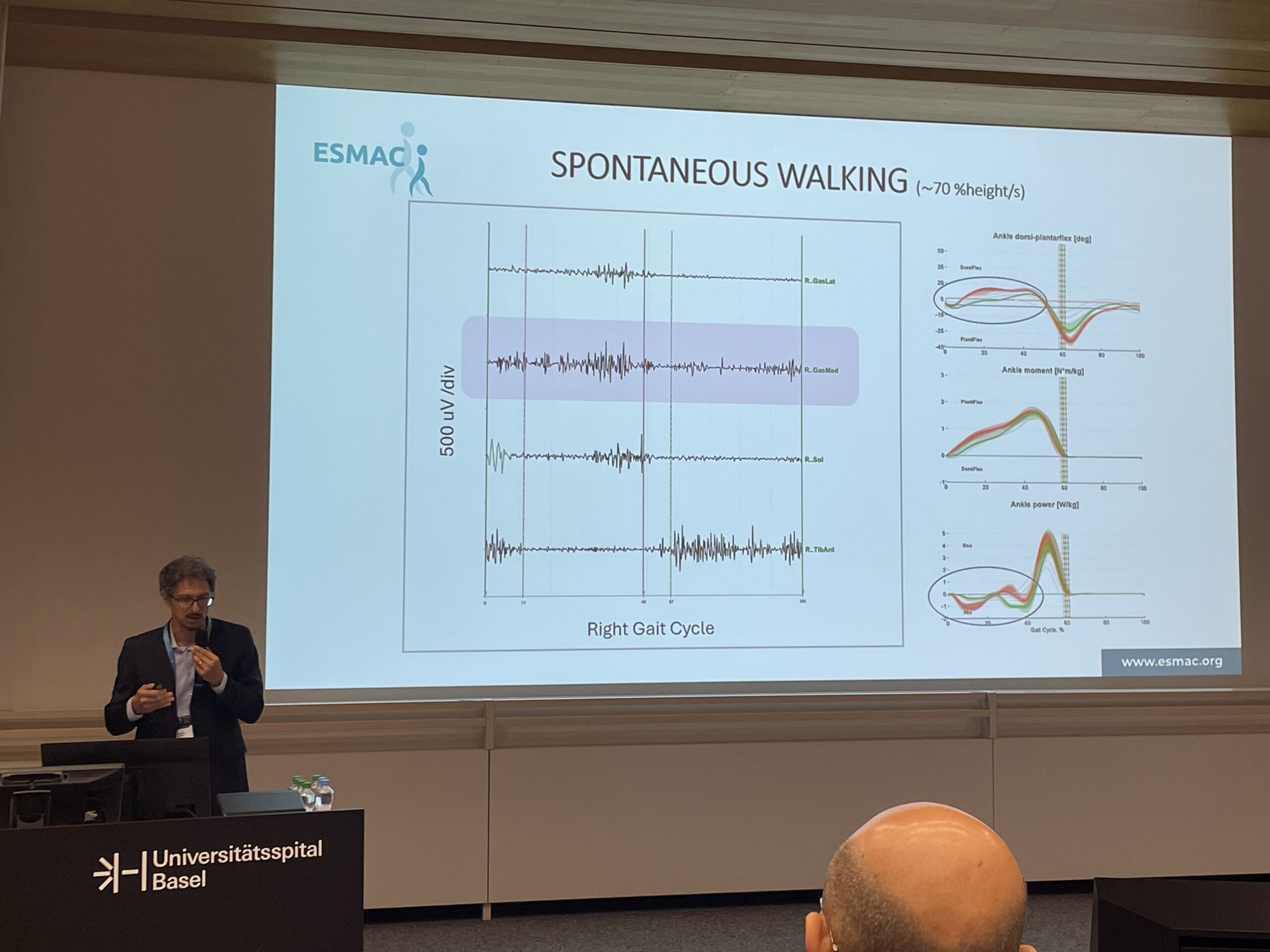 Gait analysis and Parkinson's disease